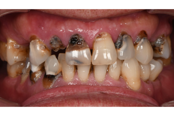 Chú Nguyễn Văn Lành- 62 tuổi