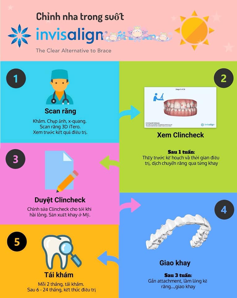 CƠ CHẾ HOẠT ĐỘNG CỦA NIỀNG RĂNG TRONG SUỐT CÔNG NGHỆ INVISALIGN: